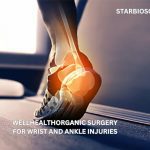 wellhealthorganic surgery for wrist and ankle injuries